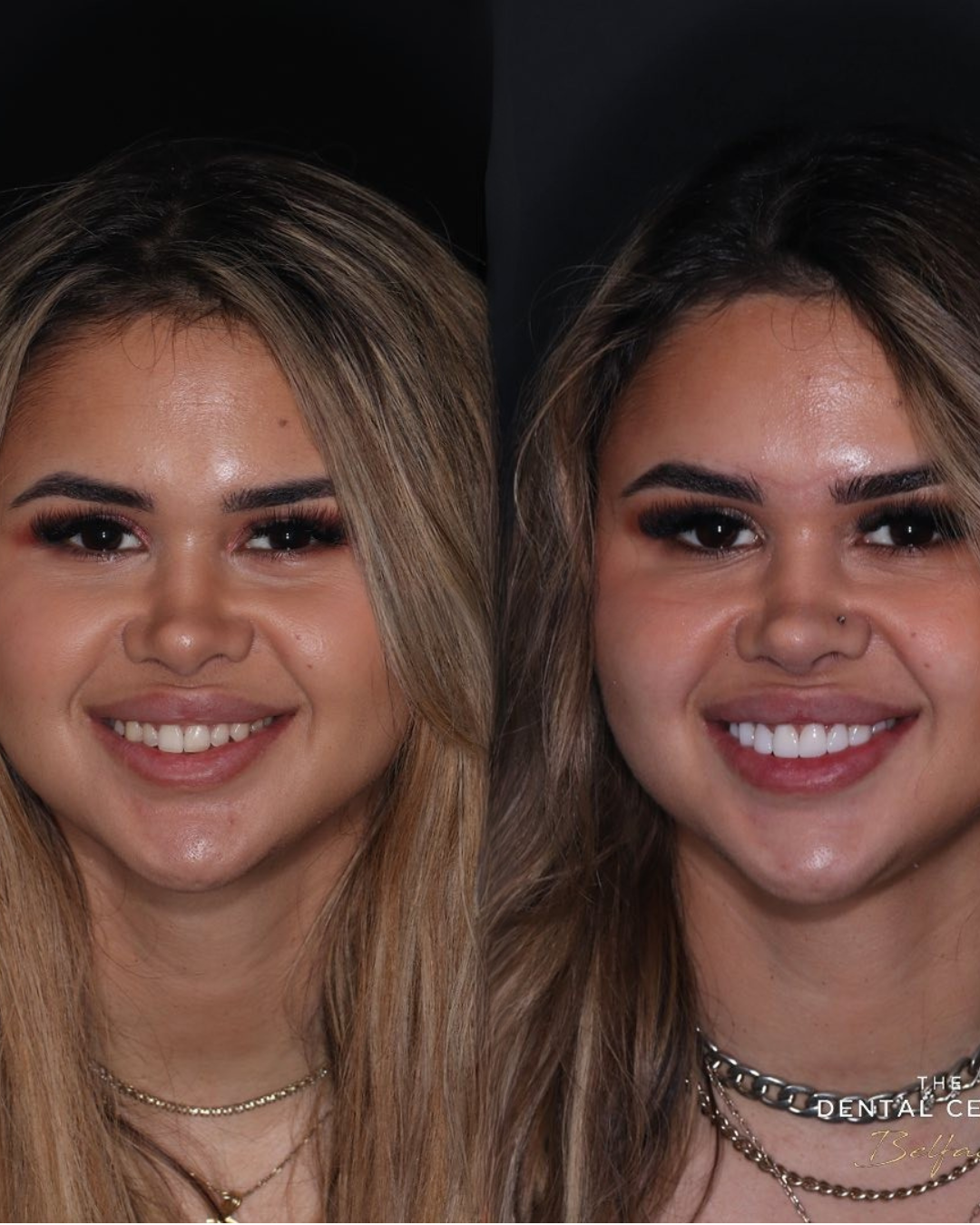 Case 3 transformation