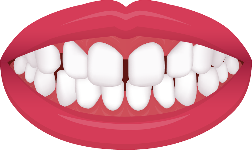 Excessive spacing illustration