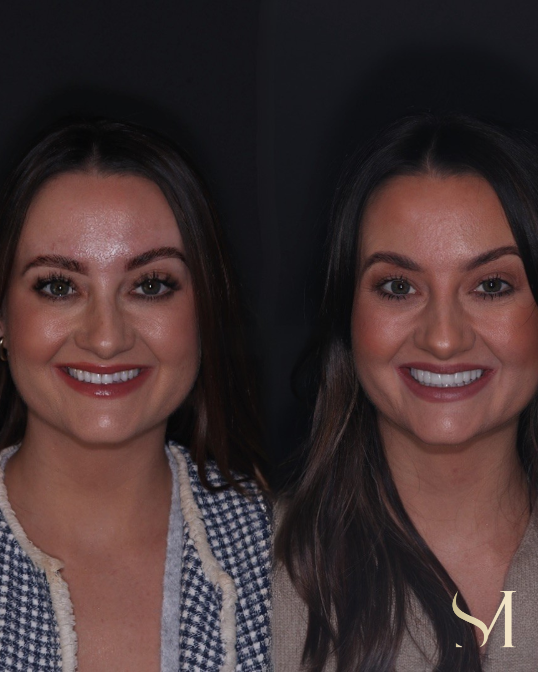 Case 1 transformation